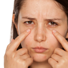 Thermage For Eye  Bags